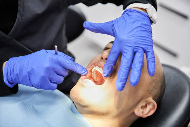 Best Emergency Gum Pain Relief  in Ama, LA