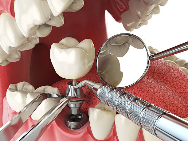 Emergency Dentist for Kids in LA